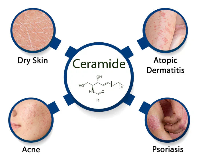 Ceramides benefits for skin barrier and hydration