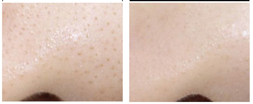 CLEANSER  REMOVAL MAKEUP