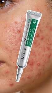 Mary&May - Spicule Azelaic PDRN Spot Cream
